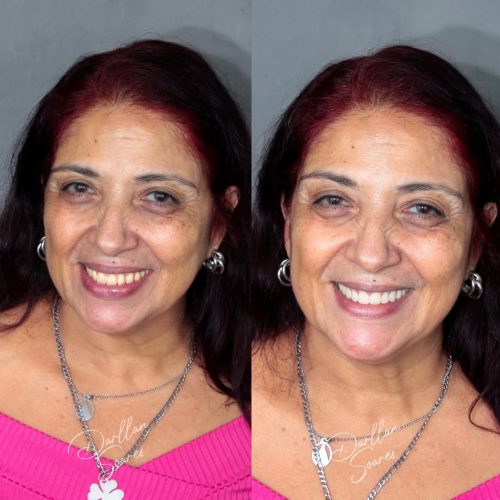 dr.darllansoares_610806686_18549120931002393_8072871348306787555_n