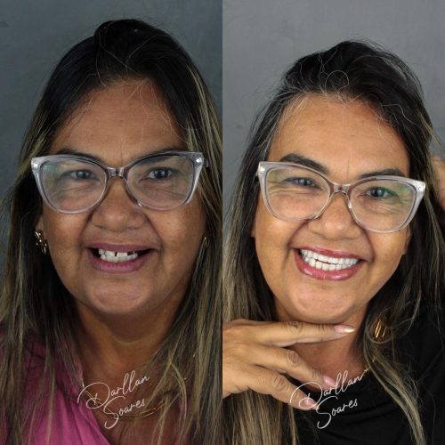 dr.darllansoares_702846542_18587369212002393_3405386017864485329_n